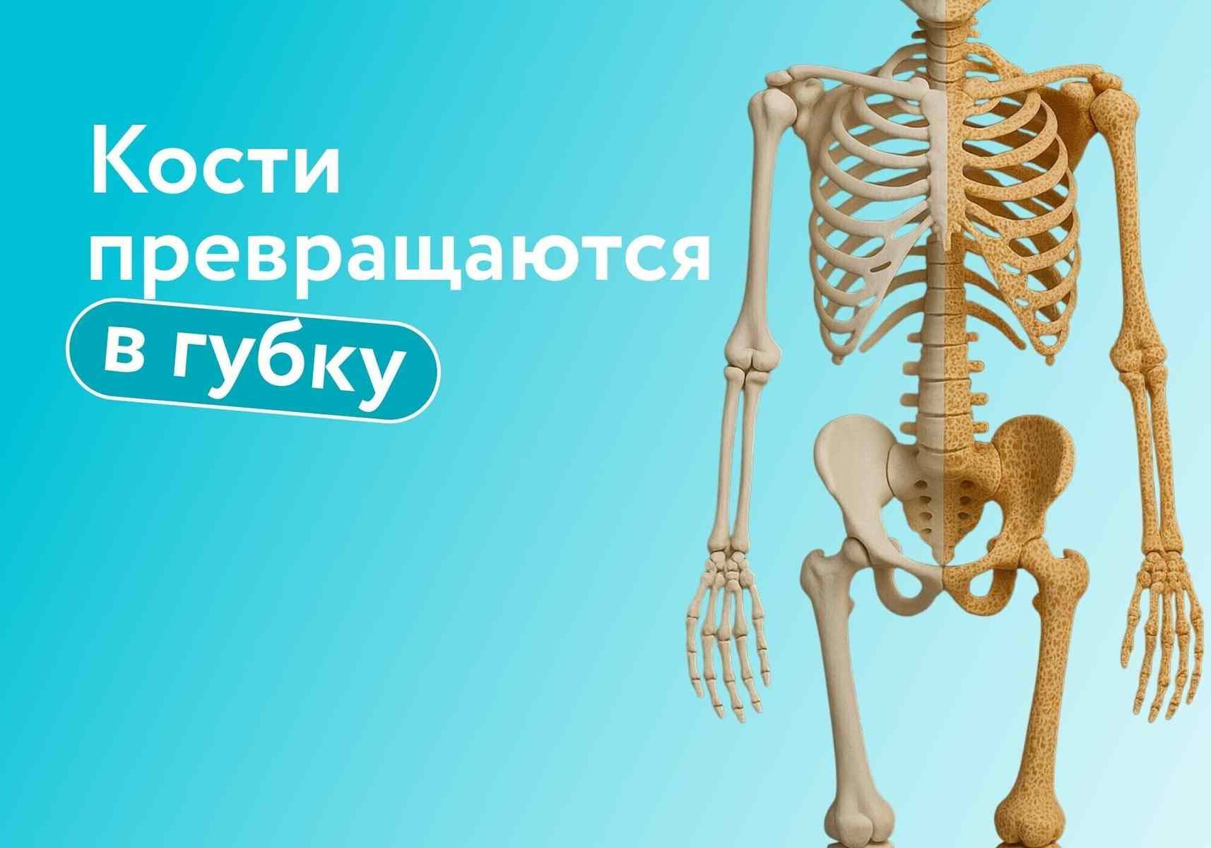 «Тихий» остеопороз: почему кости превращаются в губку, как избежать переломов и когда нужна госпитализация