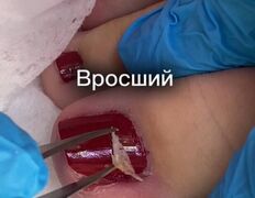 Студия ногтевого сервиса VVStudio (ВВСтудио), Подология - фото 9