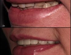 null «Стоматология в "Изумрудном"», Примеры работ - фото 1