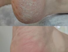 Салон красоты Шевелюра, Подология - фото 10