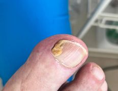 Студия подологии и эстетики  Moipodolog (Мой подолог), Подология - фото 15