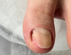 Студия подологии и эстетики  Moipodolog (Мой подолог), Подология - фото 14