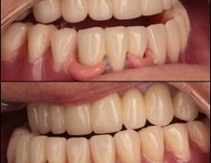 null «Стоматология в "Изумрудном"», Примеры работ - фото 8