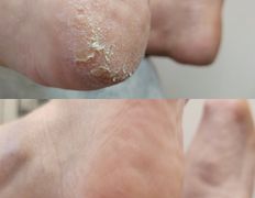 Салон красоты Шевелюра, Подология - фото 8