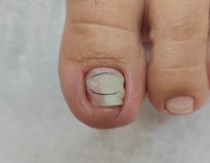 Салон красоты Шевелюра, Подология - фото 4