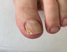 Студия подологии и эстетики  Moipodolog (Мой подолог), Подология - фото 13