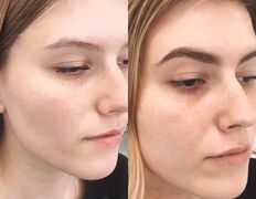 Салон красоты The Beauty Club (Зэ Бьюти Клаб), Коррекция и окрашивание бровей - фото 13