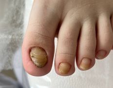 Студия подологии и эстетики  Moipodolog (Мой подолог), Подология - фото 9