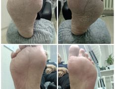 Студия подологии PodoArt (ПодоАрт), Галерея - фото 6