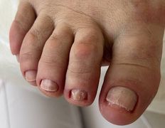 Студия подологии и эстетики  Moipodolog (Мой подолог), Подология - фото 12