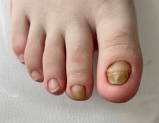 Студия подологии и эстетики  Moipodolog (Мой подолог), Подология - фото 7