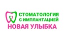 Логотип Стоматология с имплантацией «Новая улыбка» – цены - фото лого