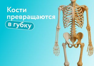 «Тихий» остеопороз: почему кости превращаются в губку, как избежать переломов и когда нужна госпитализация