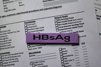 hbsag положительный пцр отрицательный
