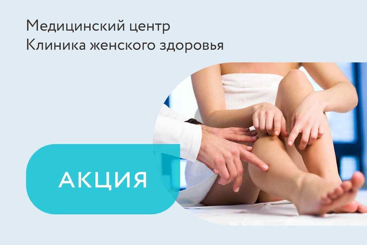 Акция на склеротерапию вен нижних конечностей