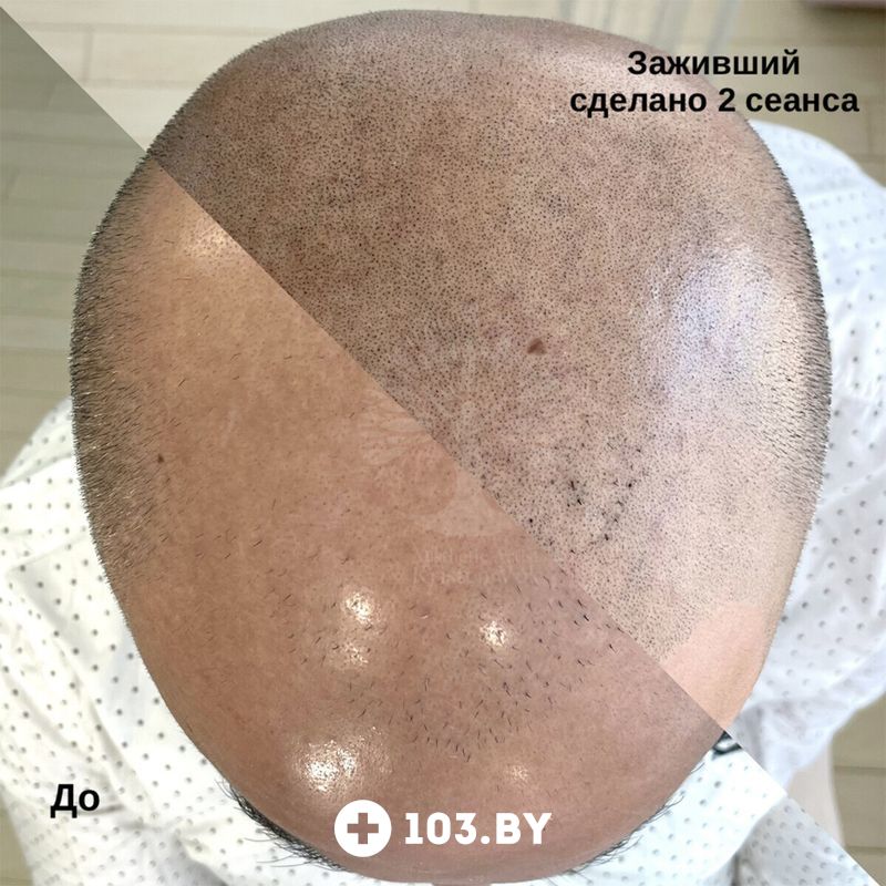 Трихопигментация Студия красоты «INTUITION (Интуишн)» - фото 2789853