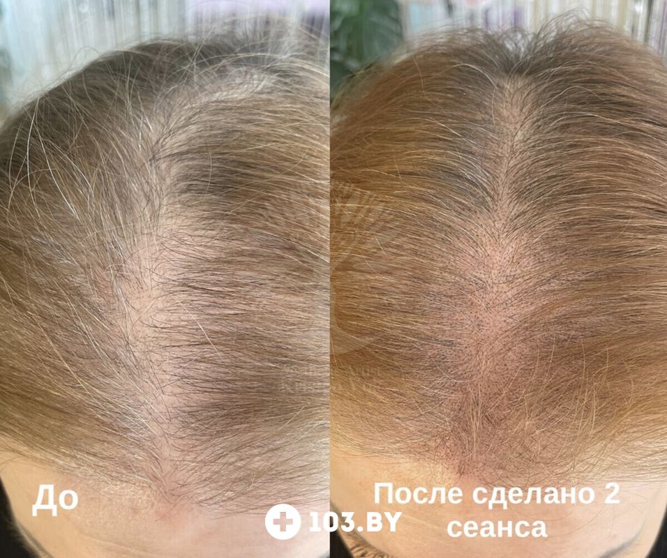 Трихопигментация Студия красоты «INTUITION (Интуишн)» - фото 2789850