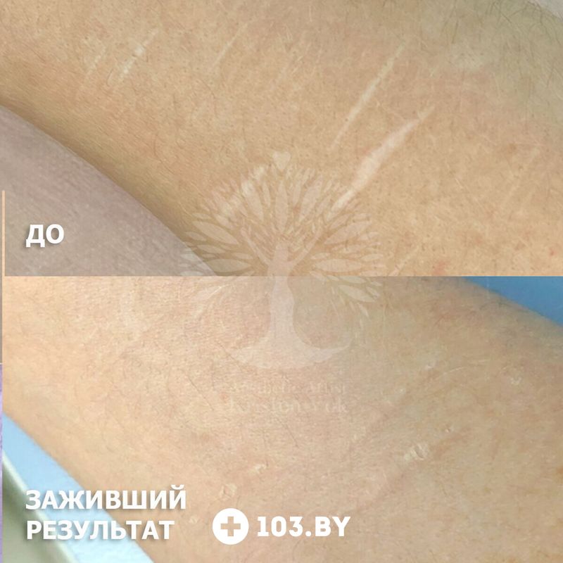 Эстетический камуфляж Студия красоты «INTUITION (Интуишн)» - фото 2789820
