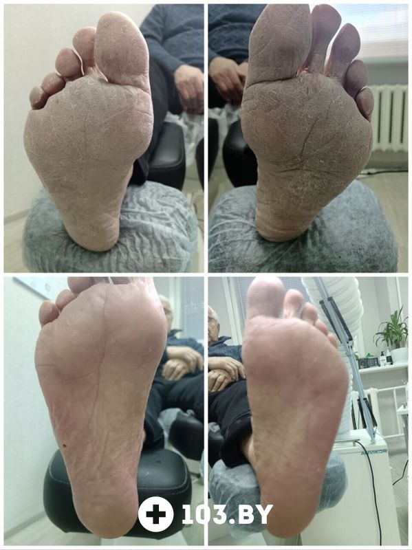 Галерея Студия подологии PodoArt (ПодоАрт) - фото 2804511