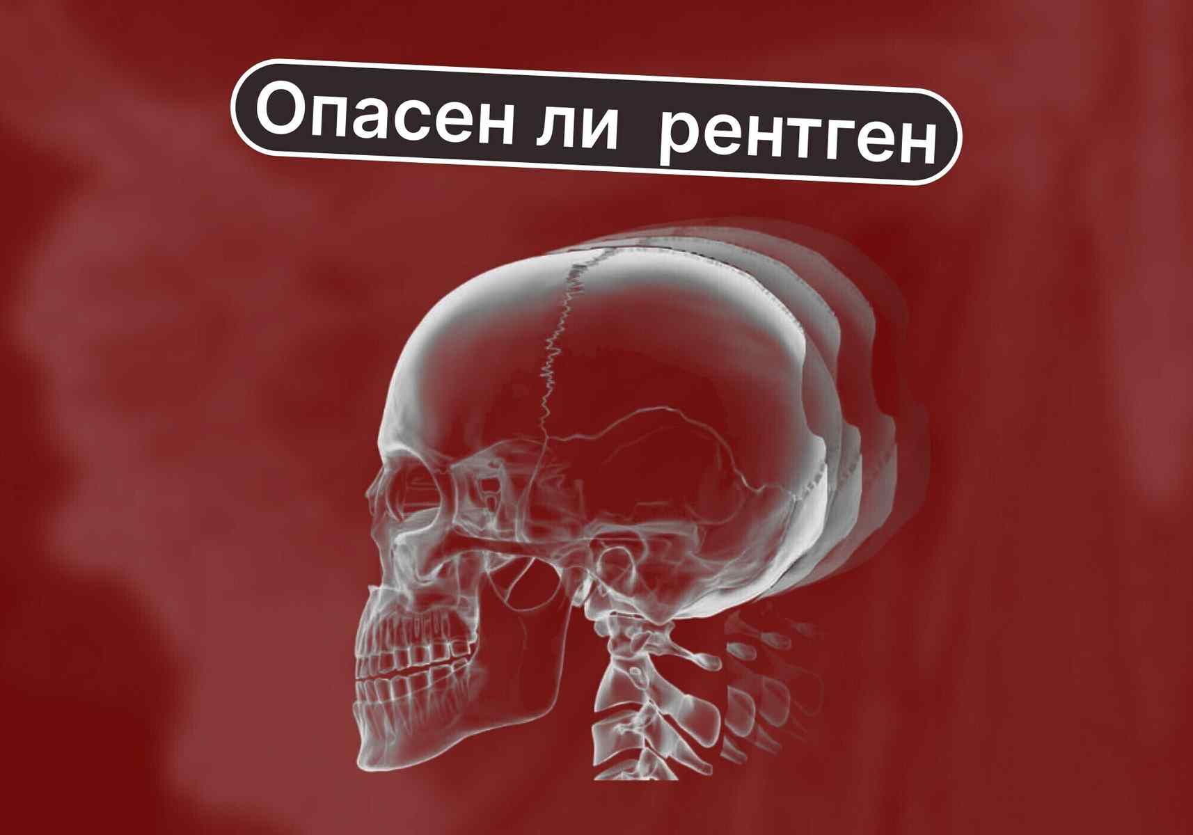 Мы получаем излучение каждый день. Насколько на самом деле опасен рентген