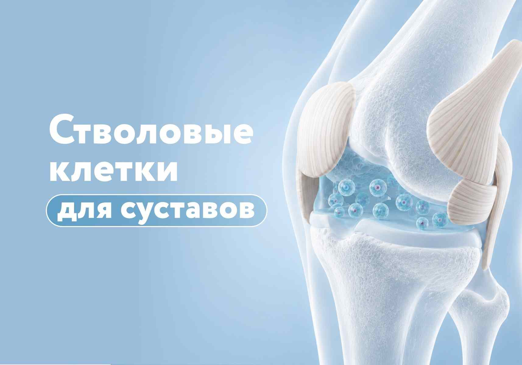 Стволовые клетки помогают лечить артроз? Белорусские медики рассказали о новой технологии