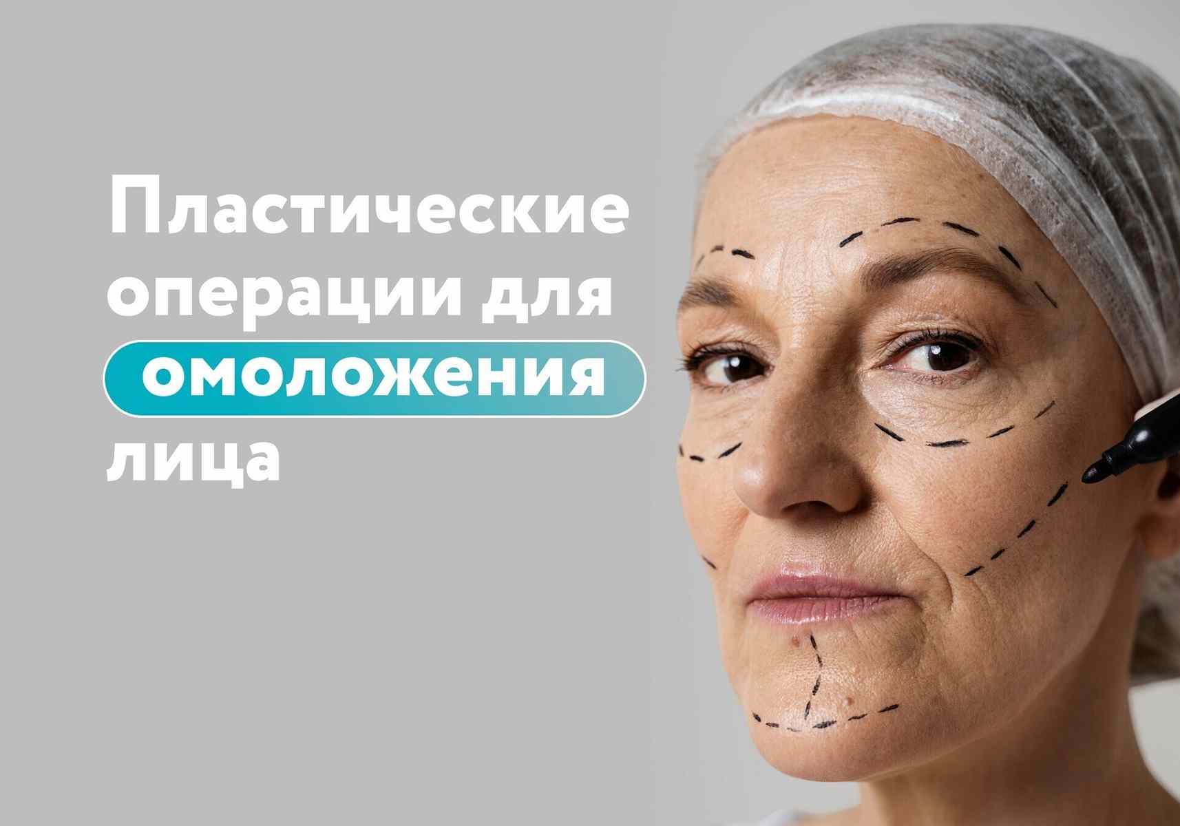 Пластические операции для омоложения лица: что выбрать?