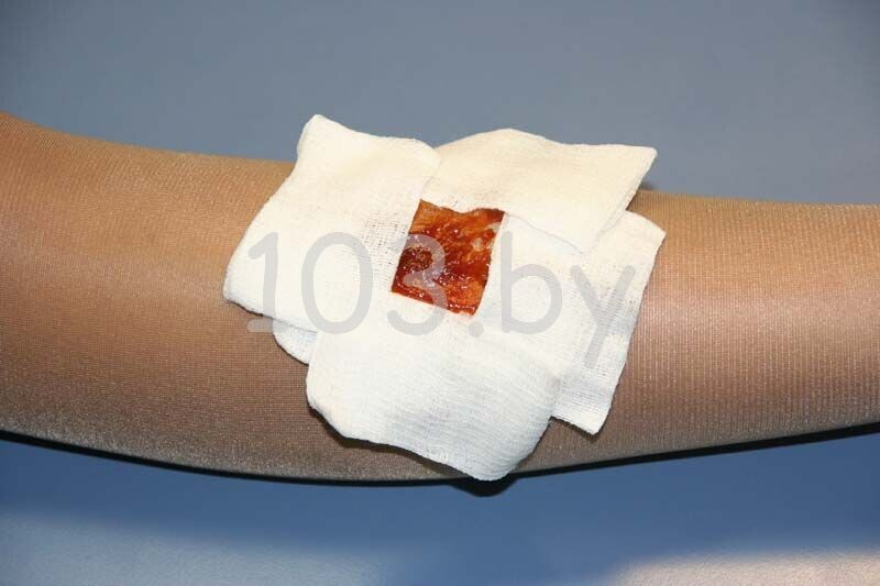 открытые переломы1.JPG открытые переломы1.JPG