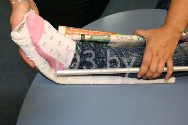 наложение шины при переломе ноги4.JPG наложение шины при переломе ноги4.JPG