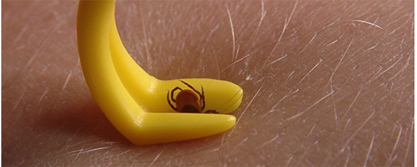 Как вытащить клеща в домашних условиях