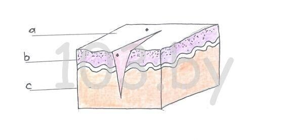 строение кожи (в разрезе).jpg