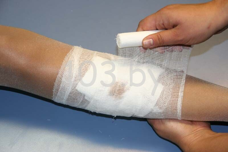 открытые переломы4.JPG открытые переломы4.JPG