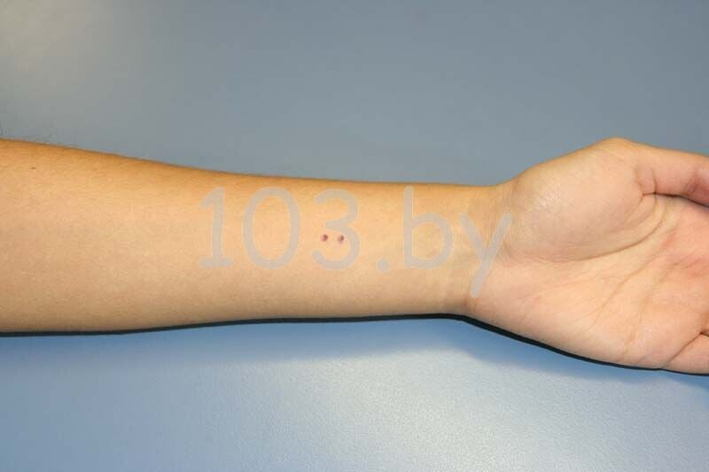 помощь при укусах змей1.JPG помощь при укусах змей1.JPG