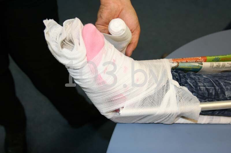 наложение шины при переломе ноги6.JPG наложение шины при переломе ноги6.JPG