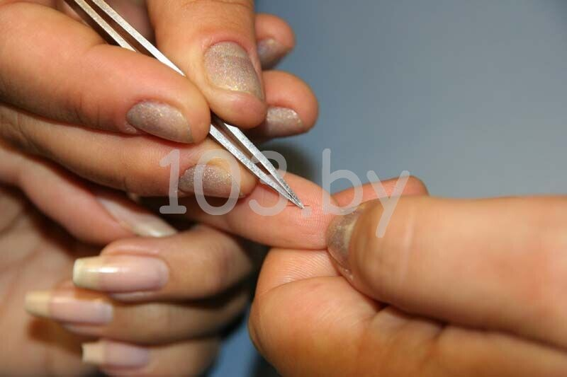 удаление заноз2.JPG удаление заноз2.JPG