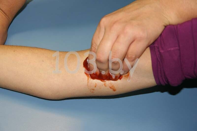 остановка кровотечение рука снизу.JPG
