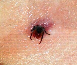 Укус клеща фото