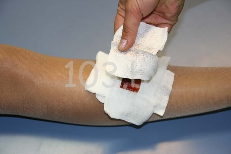 открытые переломы2.JPG открытые переломы2.JPG