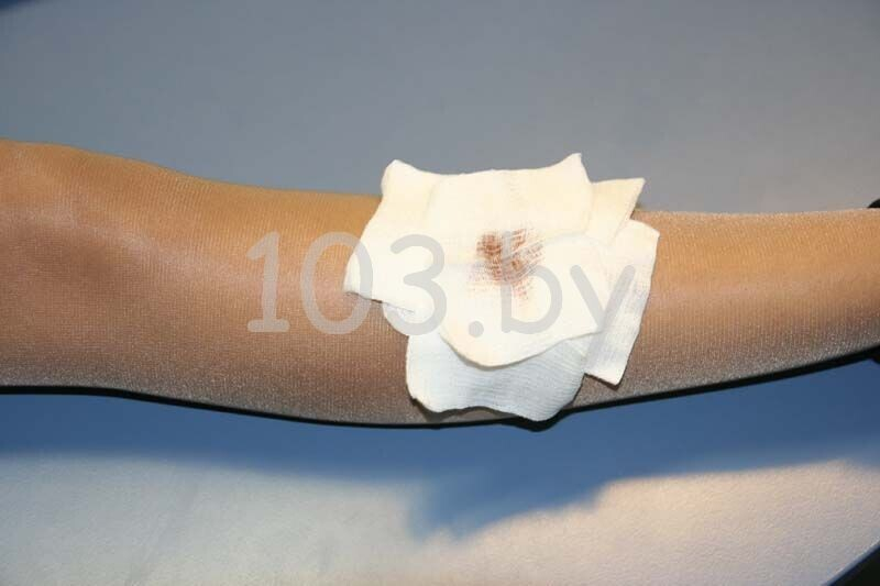 открытые переломы3.JPG открытые переломы3.JPG