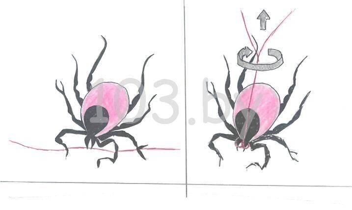 укусы насекомых. a href=