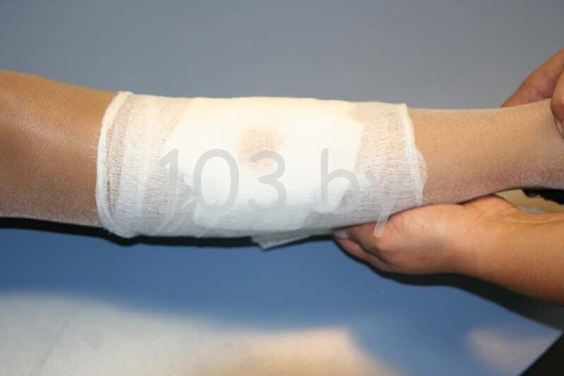 открытые переломы5.JPG открытые переломы5.JPG