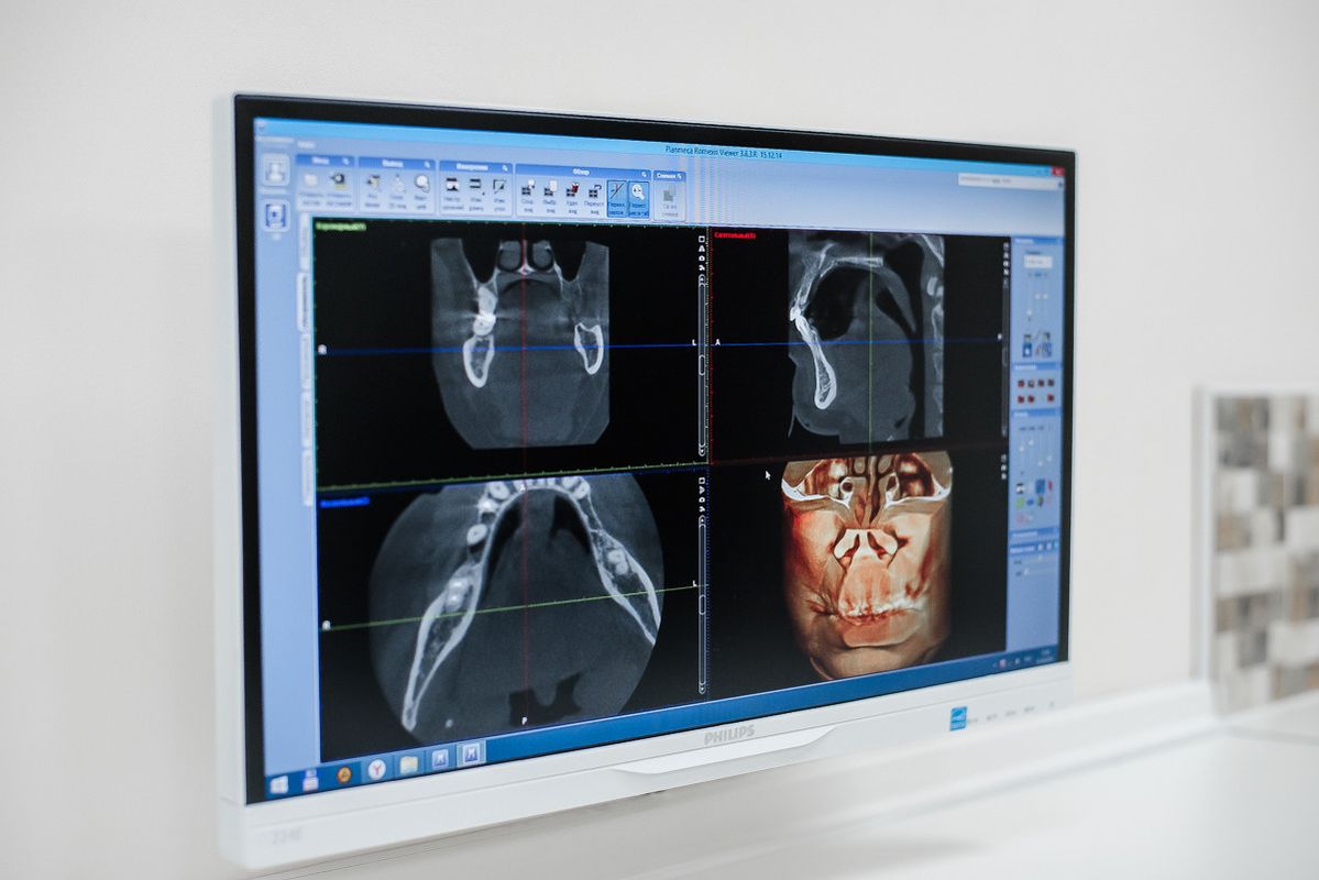 Галерея Стоматология «32 Дент» - фото 1515023