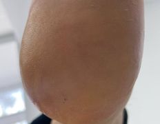 Студия подологии и эстетики IloNails studio (ИлоНеилс студио), Подология - фото 6