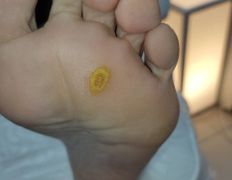 Студия ногтевого сервиса VVStudio (ВВСтудио), Подология - фото 7