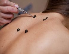 Медицинский центр Медицея, Методики - фото 2