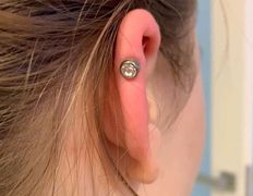 Косметический кабинет Медикал Бьюти на Грушевке, Примеры работ - фото 13