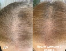 Студия красоты INTUITION (Интуишн), Трихопигментация - фото 1