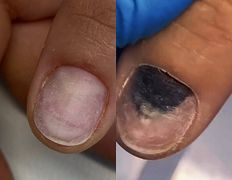 Студия ногтевого сервиса VVStudio (ВВСтудио), Подология - фото 10