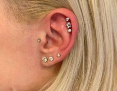 Косметический кабинет Медикал Бьюти на Грушевке, Примеры работ - фото 4