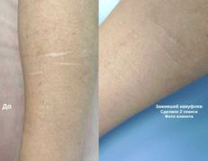 Студия красоты INTUITION (Интуишн), Эстетический камуфляж - фото 5