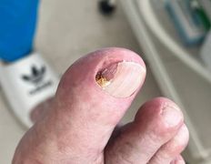 Студия подологии и эстетики  Moipodolog (Мой подолог), Подология - фото 17